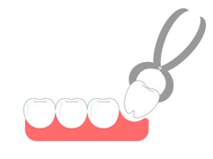 親知らずのイラスト